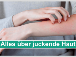 Alles über juckende Haut