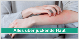 Alles über juckende Haut