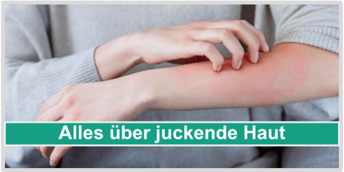 Alles über juckende Haut