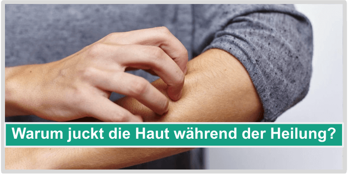 Warum juckt die Haut während der Heilung