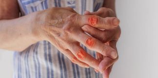 Chondroitin Wirkung Einnahme Nebenwirkungen