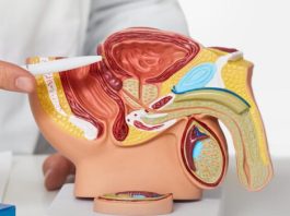 Prostata Funktion Probleme Symptome